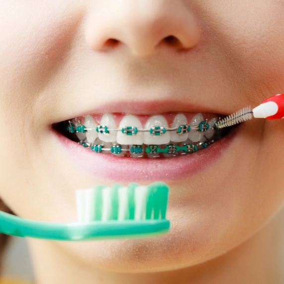 Suivez les conseils d'hygiène bucco-dentaire du Cabinet d'orthodontie HMT