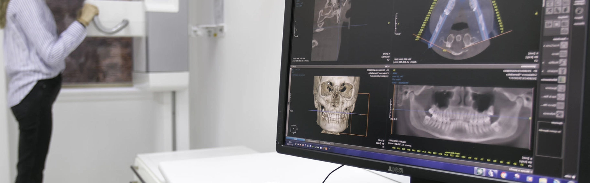 Radiographie numérique, cabinet HMT à Erstein : DRS Hildwein & Muller-Tritschler. Nos technologies