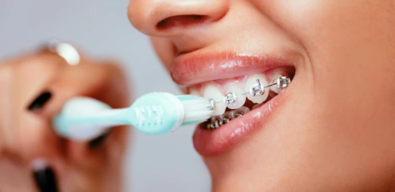 Comment réussir son traitement d’orthodontie?